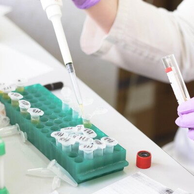 laboratory, medical, medicine, ręka, research