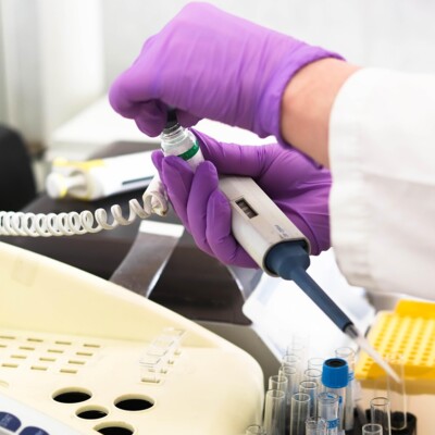 laboratory, medical, medicine, ręka, research